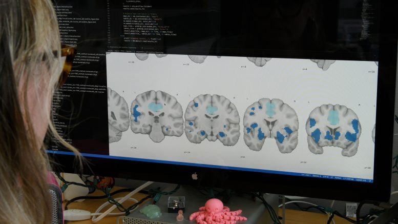 Examining Sleep Related Brain Changes