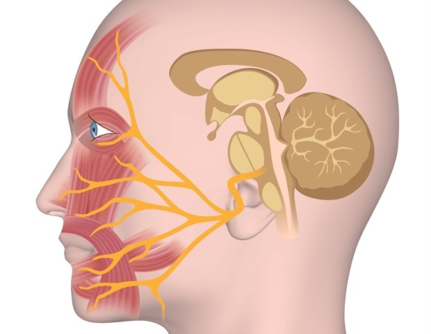 Gentle electroacupuncture effectively promotes nerve repair in facial paralysis
