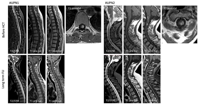 MRI scans