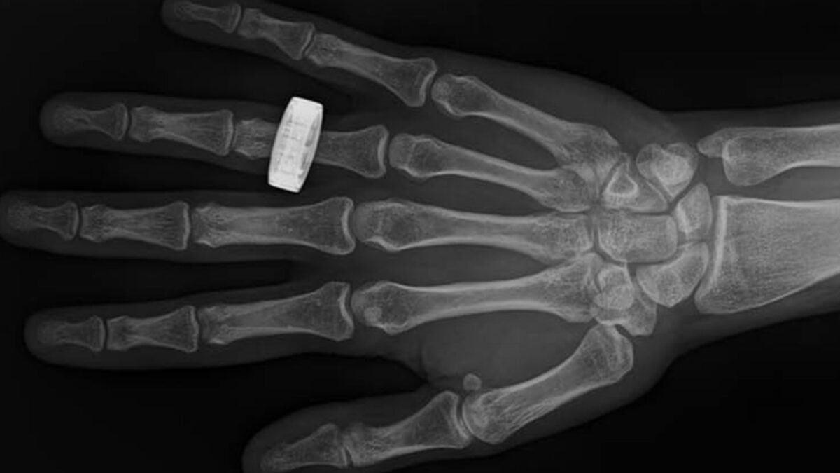 These Look Like Ordinary X-Rays. They're Not