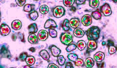 Health officials warn of measles exposure at PHL Airport on July 4th – NBC10 Philadelphia