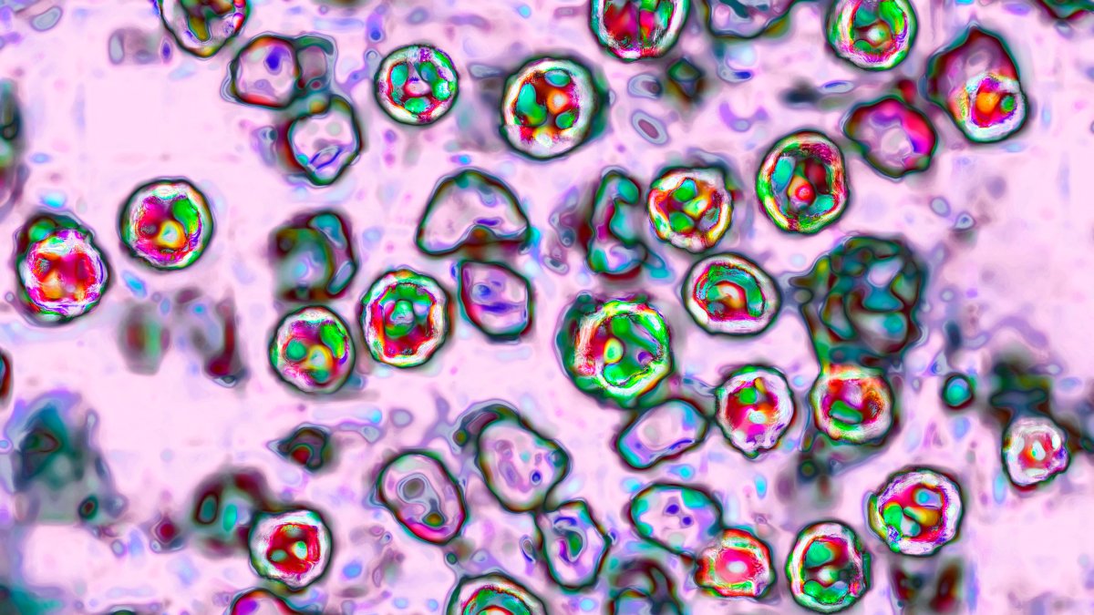 Health officials warn of measles exposure at PHL Airport on July 4th – NBC10 Philadelphia