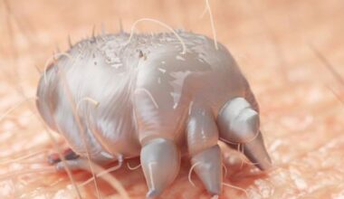 Scabies cases surge across North Island as school, health clinic issue warnings