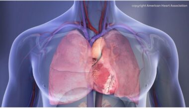 Do breast cancer and irregular heartbeat have common risk factors and rates?