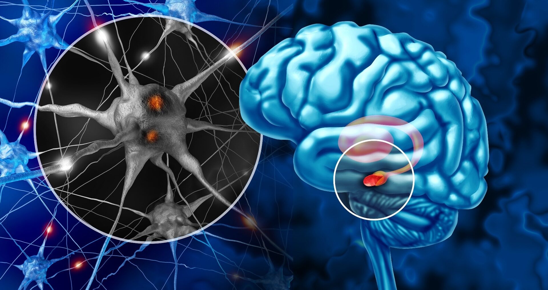 Study: Sleep and Parkinson’s disease: a population-based study from the CHARLS cohort.