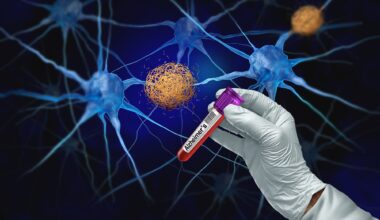 Study: Prognostic Value of Blood-Based P-Tau217 Levels for Progression to Cognitive Impairment. Image Credit: Lightspring / Shutterstock
