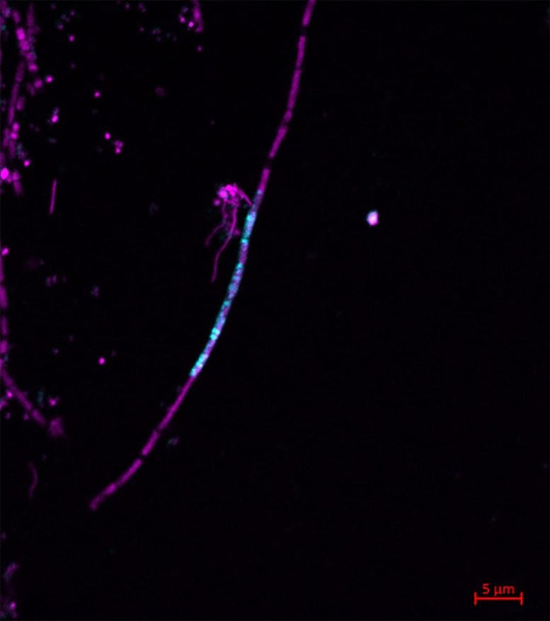 Jumping Gene RNA Inside Archaeal Cell