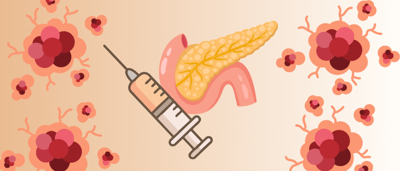 KRAS Vaccine For Pancreatic Cancer Shines In Phase I Trial