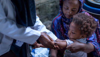Experts Warn of Health Risks, Stress Vaccines Amid Measles Resurgence