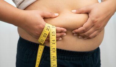 Obesity Hands Holding Belly Fat Weight Loss Struggle