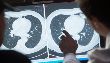 Patients warned off using AI chatbots for self-diagnosis as flaws revealed