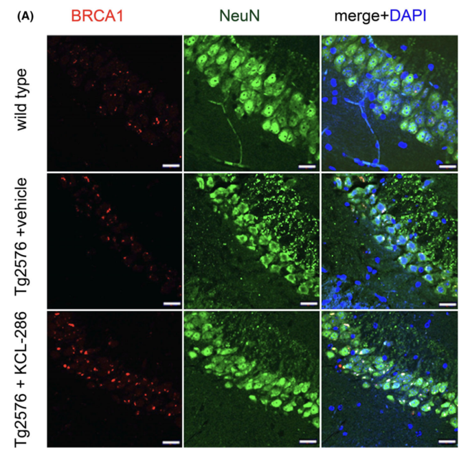 Alzheimer's Symptoms Improve in Mouse Model After Treatment With KCL-286