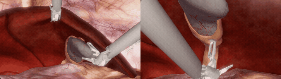 Robotic instruments manipulating simulated abdominal tissue.