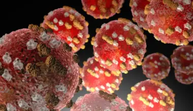 Palmerston North measles case prompts investigation into possible spread