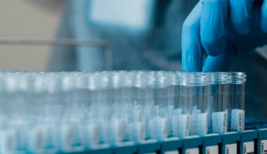 Lab technician pulls test tubes of specimens.