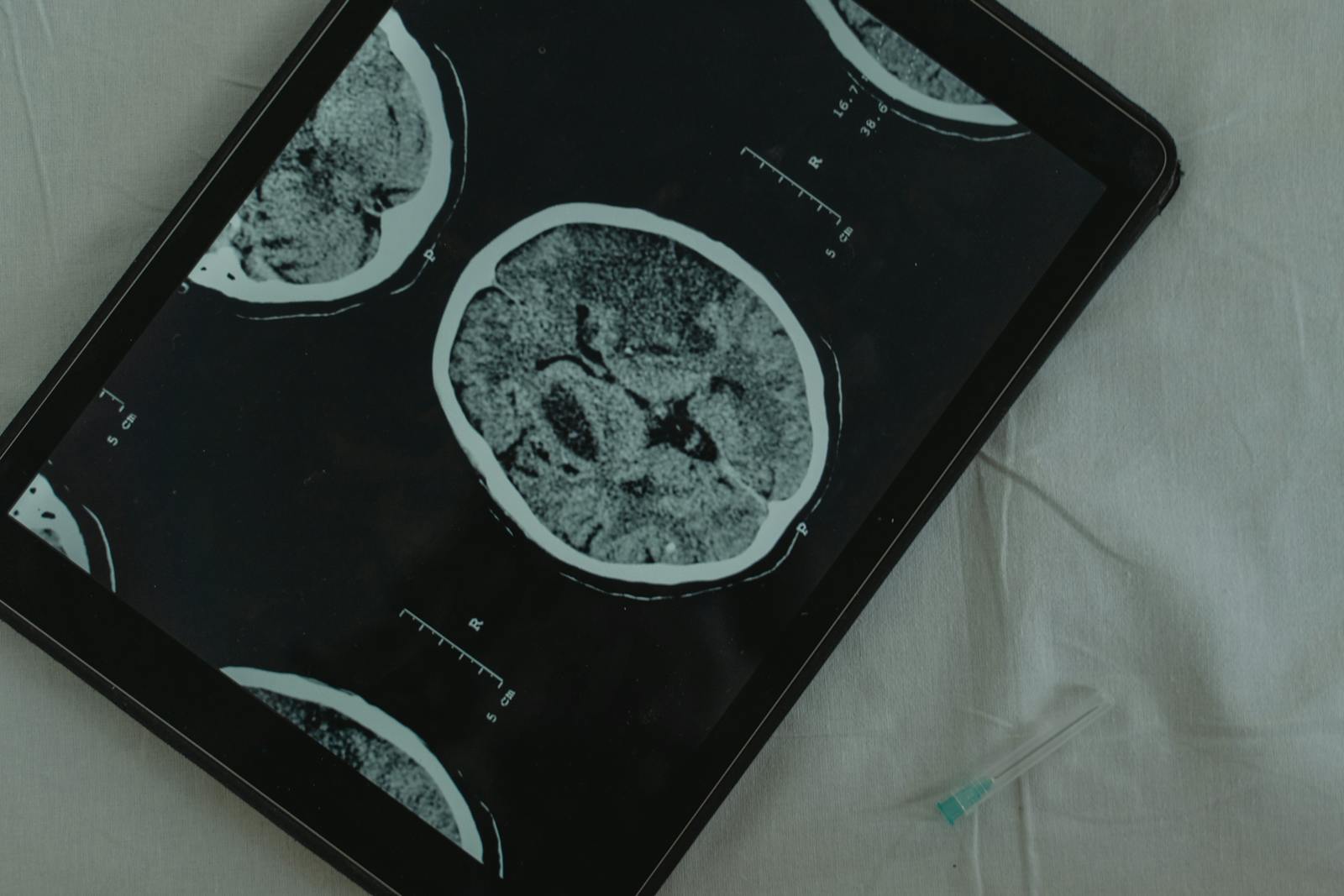 brain MRI scan