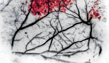 Chemistry in Pictures: Echoes of microplastics