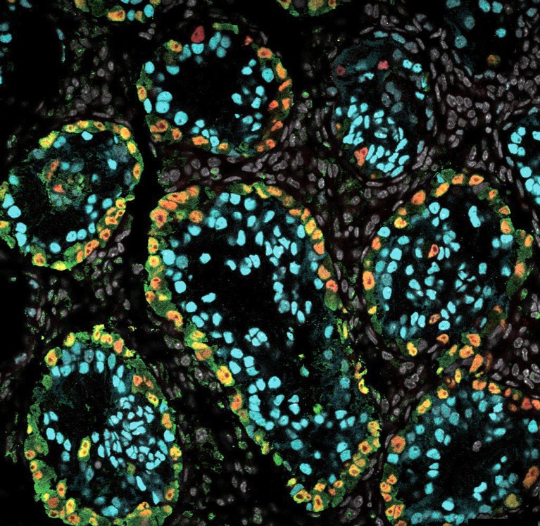 High magnification microscopy image, showing green fluorescent protein of xrTestis at 1 month post-transplantation in a rhesus macaque.