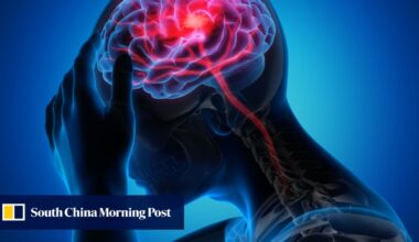 Chinese team’s wearable dopamine patch could be used to track depression, Parkinson’s