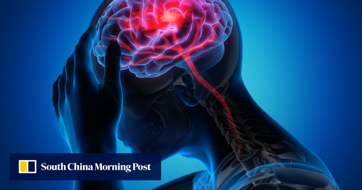 Chinese team’s wearable dopamine patch could be used to track depression, Parkinson’s
