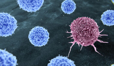 Department of Cancer Sciences head outlines vision for comprehensive cancer centre