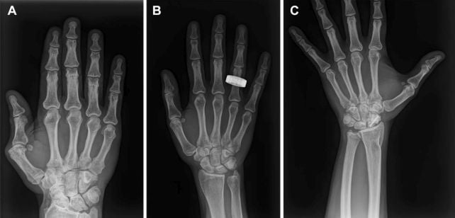 Astronauts Have Spent 65 Years Without X-Rays. That's Finally Changing.
