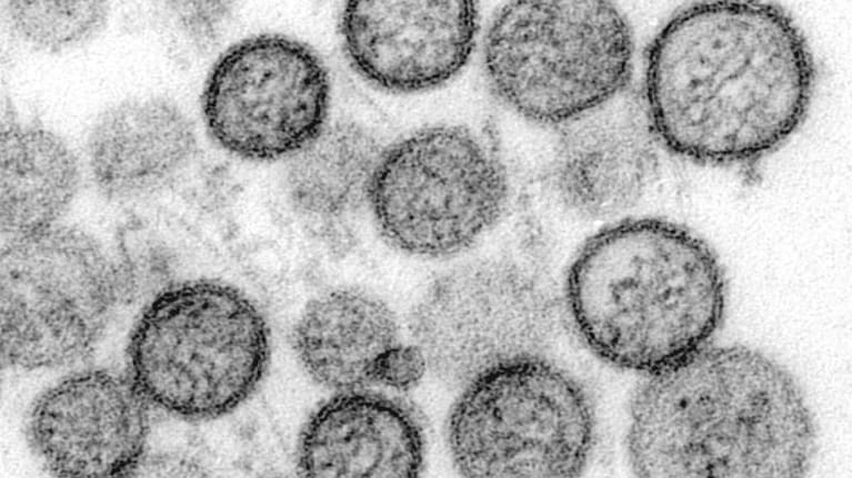 Hantavirus.