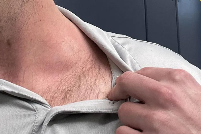 A person adjusting their shirt collar, showing their neck, a medical symptom doctors wish people would not ignore.