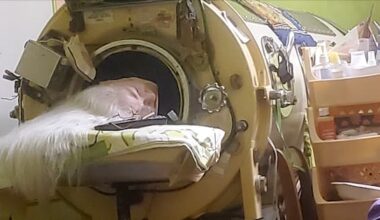 Martha Lillard, last US polio patient using iron lung, dies at 78