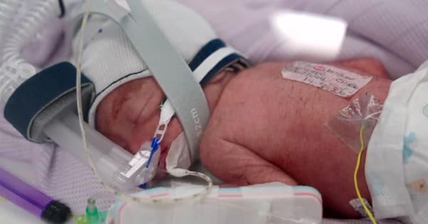 One in 15 million: Australian mum delivers rare quadruplets