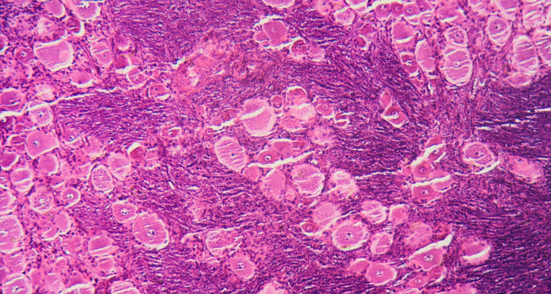 Researchers Develop a Safer, More Reliable Material for Growing Small-Scale Models of the Human Gut