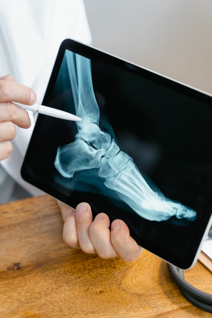 ER staff examining a patient's foot x-ray on a tablet, highlighting the challenges faced by ER staff.