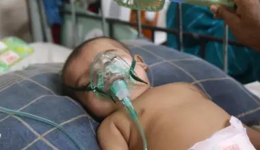 2 more suspected measles deaths, toll reaches 731