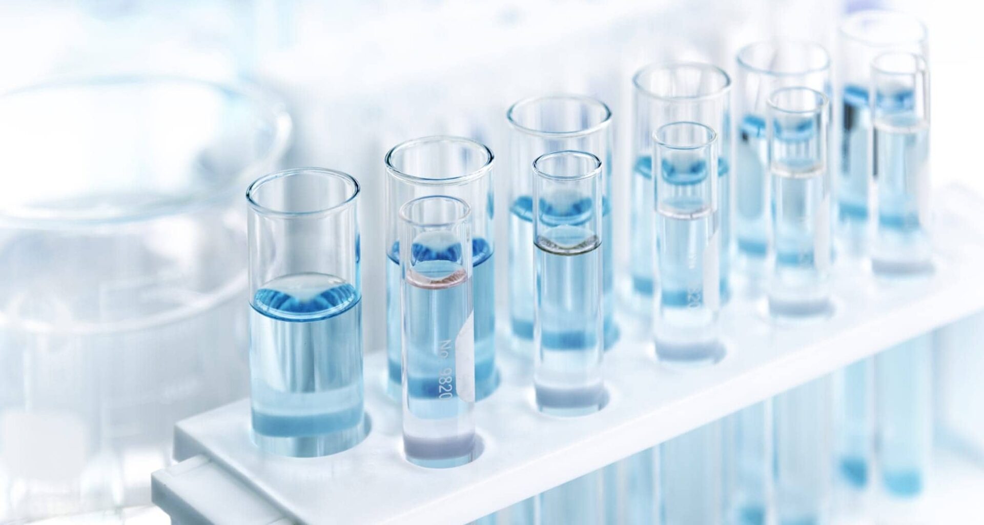 Diabetes Test May Misdiagnose Patients With Sickle Cell Trait