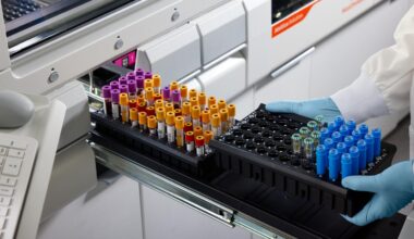 Siemens Healthineers Launches an Industry-leading Menu for Core Lab Capillary Testing on Atellica Analyzers with Claims for 24 Assays