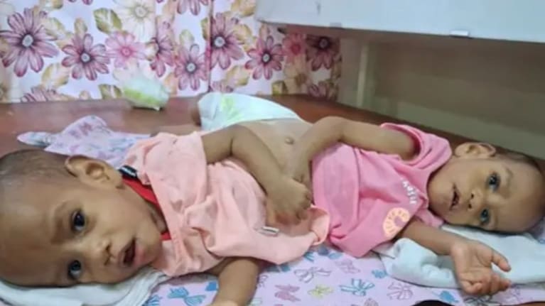 The Saudi Arabia government has fully funded their entire trip, covering airfares and accommodation for the triplets and their parents.
