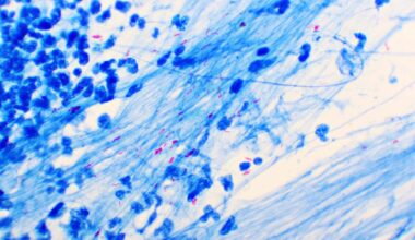 Intelligenome, Cornell Partner on Portable TB Diagnostic