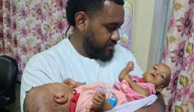 Saudi Arabia helps conjoined Fijian twins – other nations asked for $1m