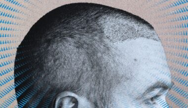 Does Creatine Cause Hair Loss?