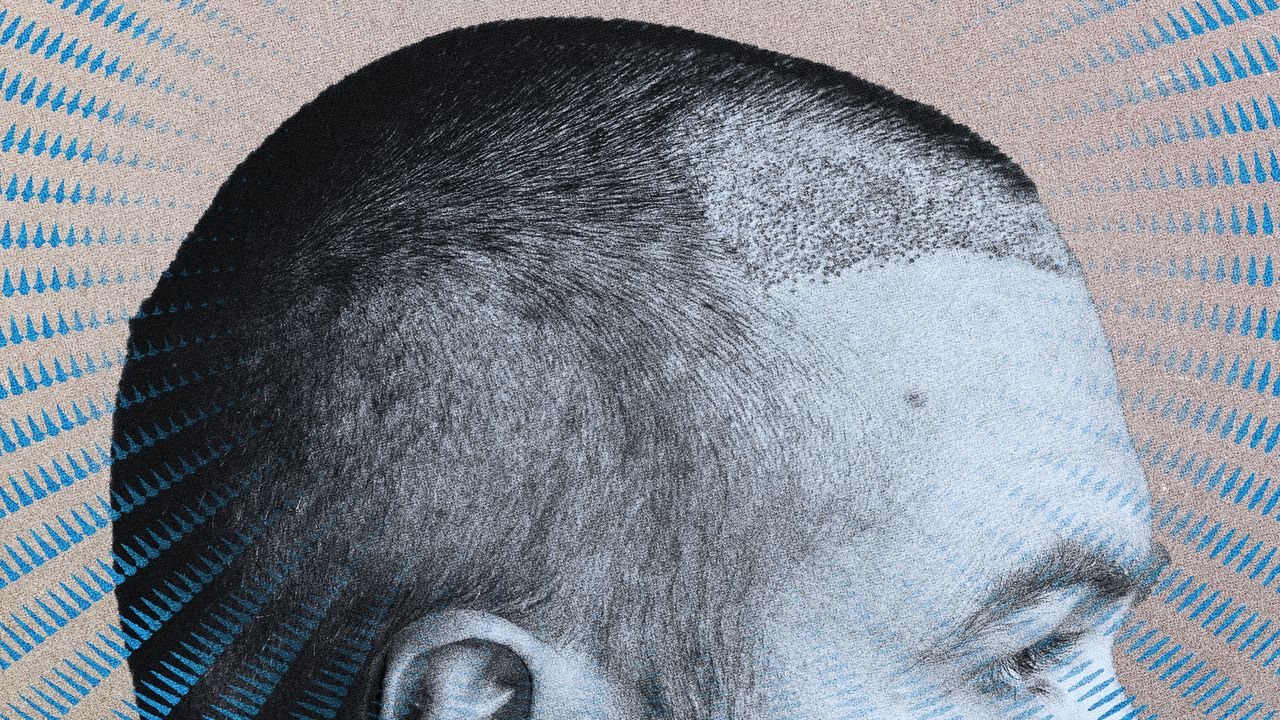 Does Creatine Cause Hair Loss?