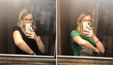 Woman Almost Ignored Arm Pain After Workout—Then Comes Terrifying Diagnosis