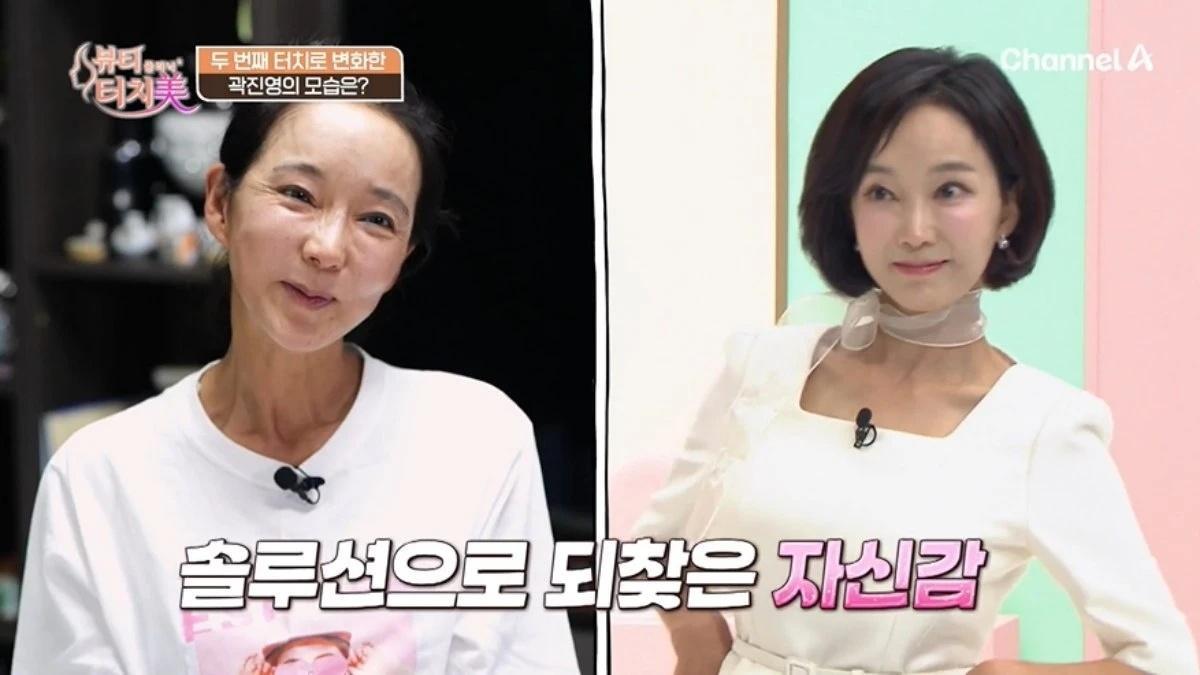 Kwak Jin-young / Captured from ChannelA