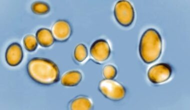Deadly fungus rapidly spreading across the U.S.