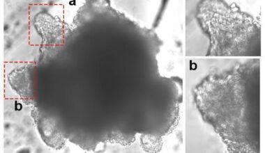 Human heart organoids with functioning valves model cardiac valve disorders