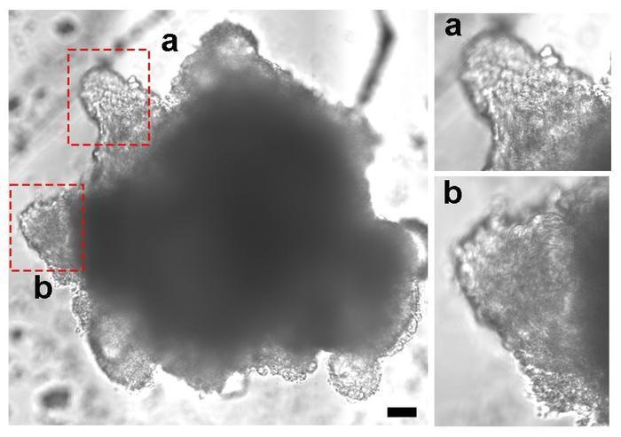 Human heart organoids with functioning valves model cardiac valve disorders