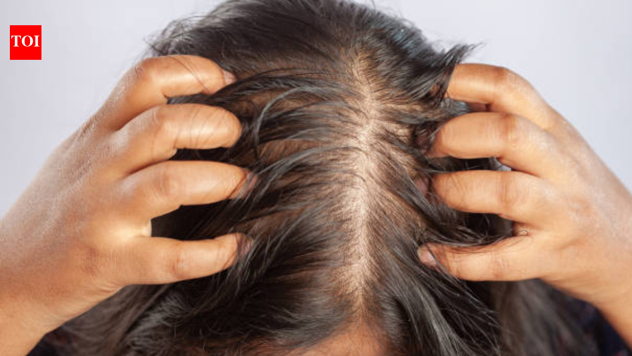 India's fitness boom comes with a hidden cost: Expert reveals what creatine could mean for your hairline |