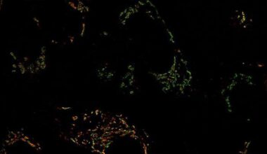 MYC-driven breast cancer metabolic vulnerability: mitochondria and glutamine dependence offer new drug target