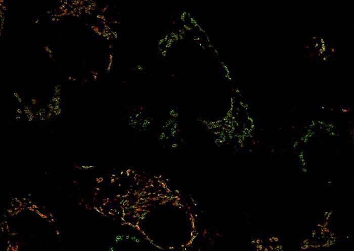 MYC-driven breast cancer metabolic vulnerability: mitochondria and glutamine dependence offer new drug target