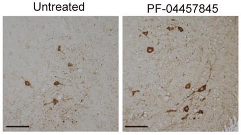 Low-Res_fig5_E_JCIinsight _revised