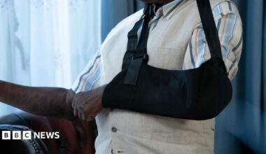 A close-up image of  man's left arm in a black sling. He is also wearing a white waistcoat and striped, short-sleeved shirt.